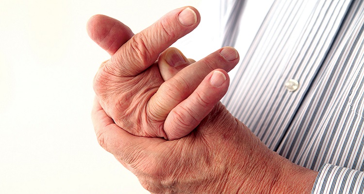Triệu chứng tê tay ở người bị bệnh phong tê thấp (Nguồn ảnh: internet)
